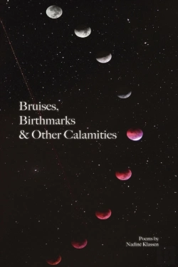 Bertrand.pt - Bruises, Birthmarks   Other Calamities