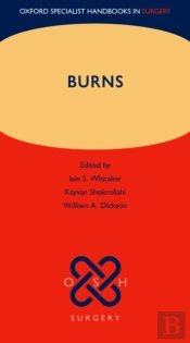 Burns