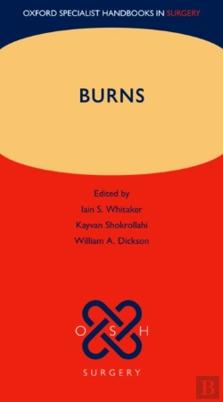 Bertrand.pt - Burns