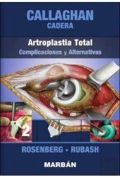 Cadera: Artroplastia Total: Complicaciones Y Alternativas