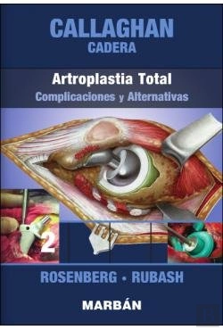 Bertrand.pt - Cadera: Artroplastia Total: Complicaciones Y Alternativas