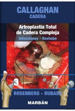 Bertrand.pt - Cadera: Artroplastia Total De Cadera Compleja: Infecciones - Revision