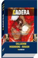 Cadera