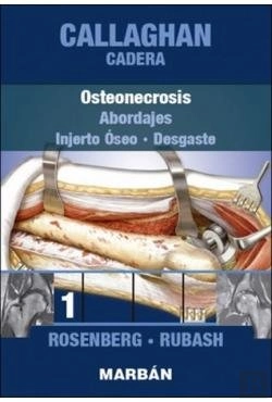 Bertrand.pt - Cadera Tomo 1: Osteonecrosis, Injerto Óseo, Desgaste