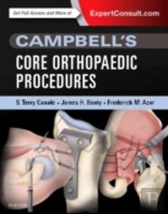 Campbell'S Top 100 Orthopaedic Procedures