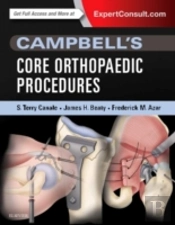 Campbell'S Top 100 Orthopaedic Procedures