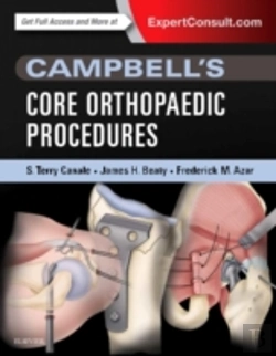 Bertrand.pt - Campbell'S Top 100 Orthopaedic Procedures