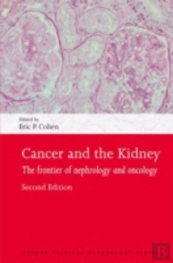 Bertrand.pt - Cancer And The Kidney