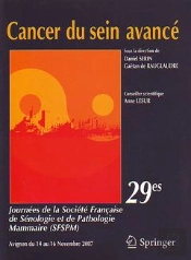 Cancer Du Sein Avance