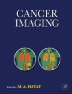 Bertrand.pt - Cancer Imaging