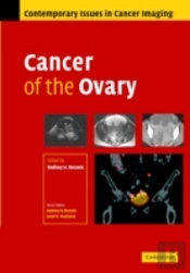 Cancer Of The Ovary