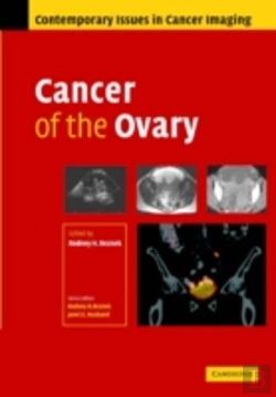 Bertrand.pt - Cancer Of The Ovary