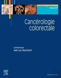 Bertrand.pt - Cancérologie Colorectale