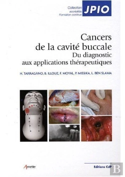 Bertrand.pt - Cancers De La Cavite Buccale - Du Diagnostic Aux Applications Therapeutiques