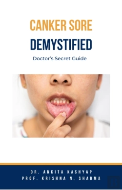 Bertrand.pt - Canker Sore Demystified: Doctor'S Secret Guide
