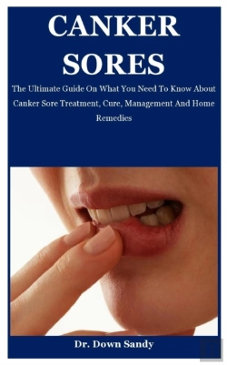 Bertrand.pt - Canker Sores