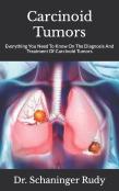 Carcinoid Tumors