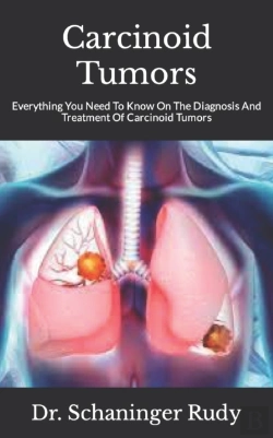 Bertrand.pt - Carcinoid Tumors