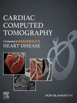 Bertrand.pt - Cardiac Computed Tomography -E-Book