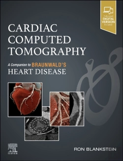 Bertrand.pt - Cardiac Computed Tomography