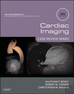 Bertrand.pt - Cardiac Imaging: Case Review Series E-Book