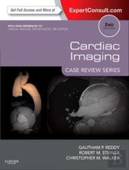 Cardiac Imaging