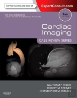 Bertrand.pt - Cardiac Imaging