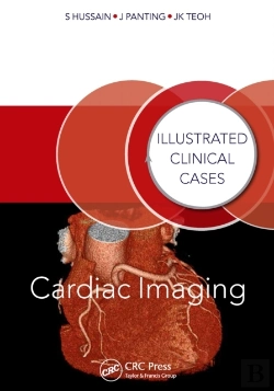 Bertrand.pt - Cardiac Imaging