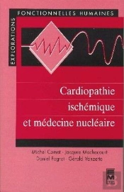 Cardiographie Ischemique Et Medecine Nucleaire