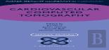 Cardiovascular Computed Tomography