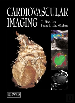 Bertrand.pt - Cardiovascular Imaging