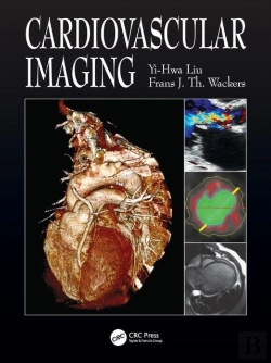 Bertrand.pt - Cardiovascular Imaging