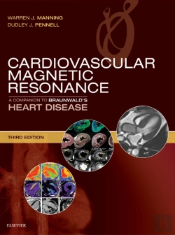 Bertrand.pt - Cardiovascular Magnetic Resonance