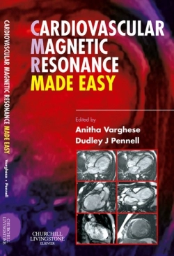 Bertrand.pt - Cardiovascular Magnetic Resonance Made Easy
