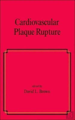 Bertrand.pt - Cardiovascular Plaque Rupture
