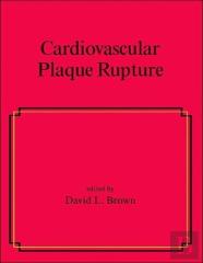 Cardiovascular Plaque Rupture