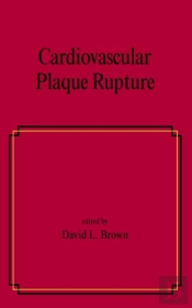 Cardiovascular Plaque Rupture