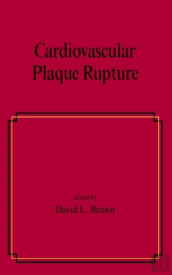 Bertrand.pt - Cardiovascular Plaque Rupture
