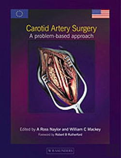 Bertrand.pt - Carotid Artery Surgery