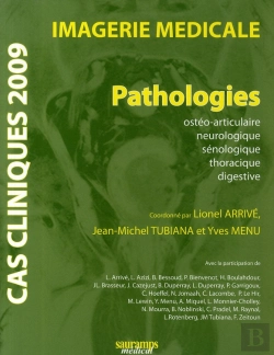 Bertrand.pt - Cas Cliniques 2009 ; Imagerie Médicale ; Pathologies Osthéo-Articulaire, Neurolo, Seinolo, Thorac. Digestive