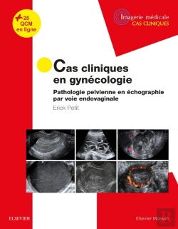 Bertrand.pt - Cas Cliniques En Gynécologie