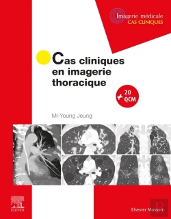Bertrand.pt - Cas Cliniques En Imagerie Thoracique
