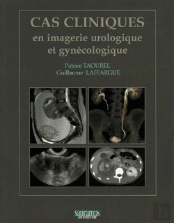 Bertrand.pt - Cas Cliniques En Imagerie Urologique Et Gynécologique