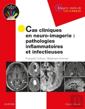Cas Cliniques En Neuro-Imagerie : Pathologies Inflammatoires Et Infectieuses