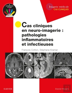 Bertrand.pt - Cas Cliniques En Neuro-Imagerie : Pathologies Inflammatoires Et Infectieuses