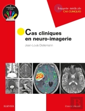 Cas Cliniques En Neuro-Imagerie ; Pathologies Tumorales