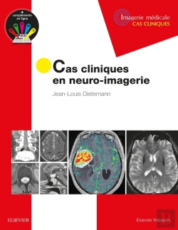 Bertrand.pt - Cas Cliniques En Neuro-Imagerie ; Pathologies Tumorales
