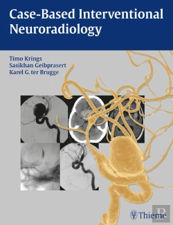Bertrand.pt - Case-Based Interventional Neuroradiology