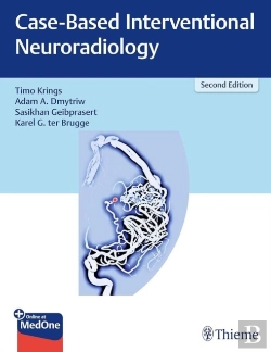Bertrand.pt - Case-Based Interventional Neuroradiology