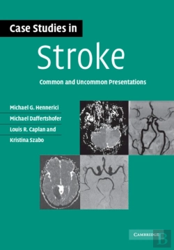 Bertrand.pt - Case Studies In Stroke